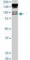 PML Antibody (monoclonal) (M02)